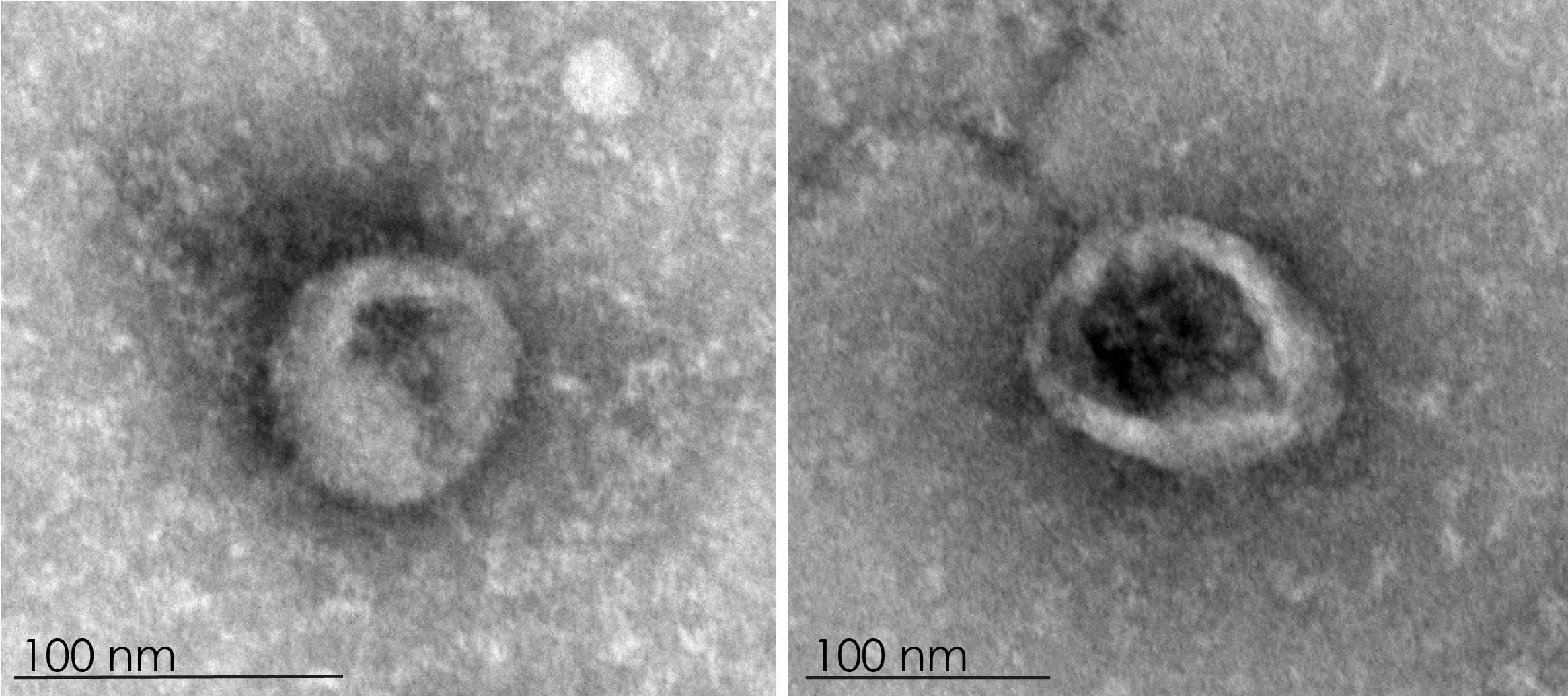 Acute fever of arboviral aetiology: host-derived immune factors and circulating extracellular vesicles as novel early biomarkers